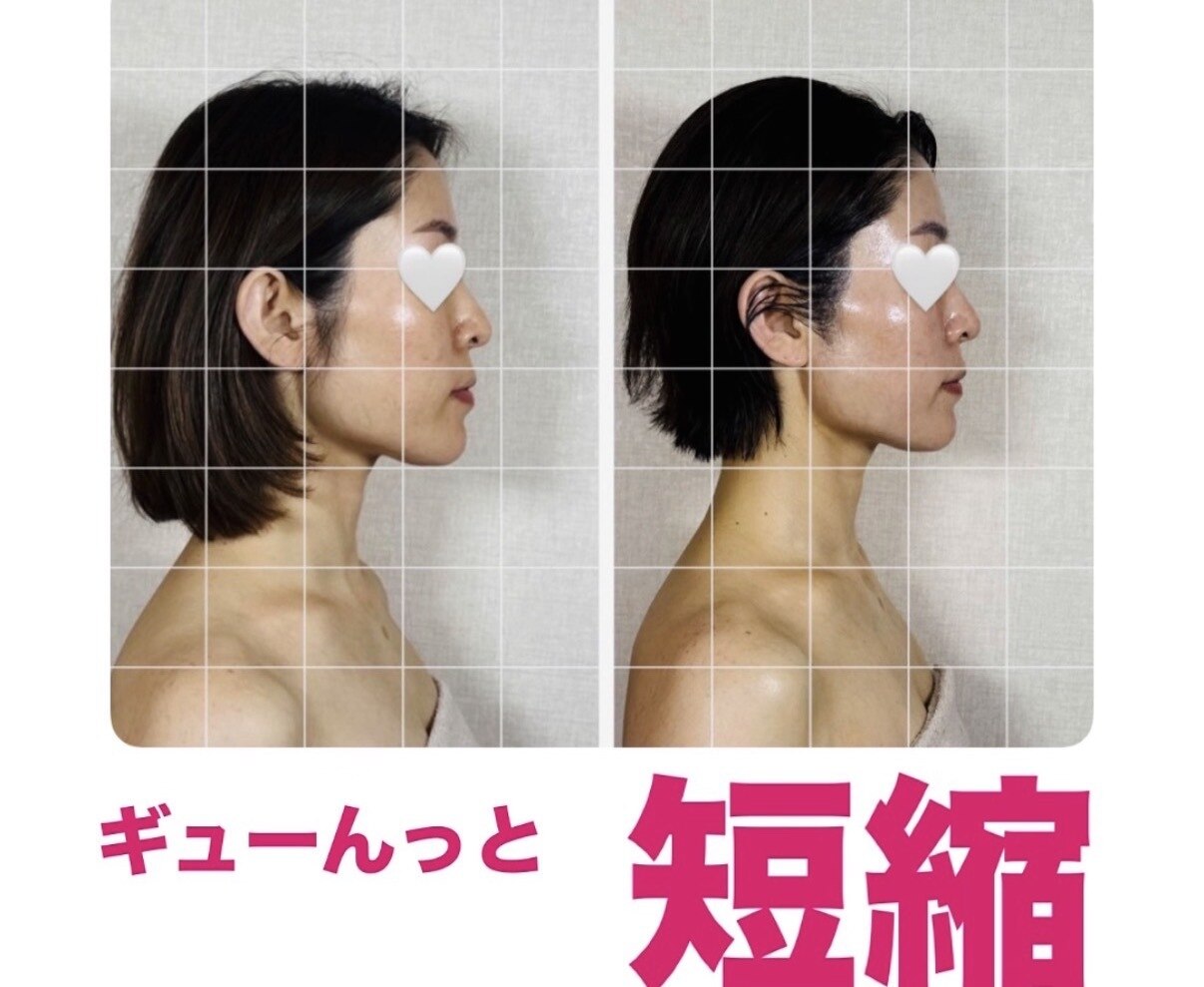肩・首・背中集中ケア