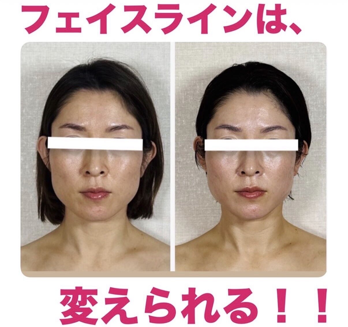 カウンセリング重視のオーダーメイド施術
