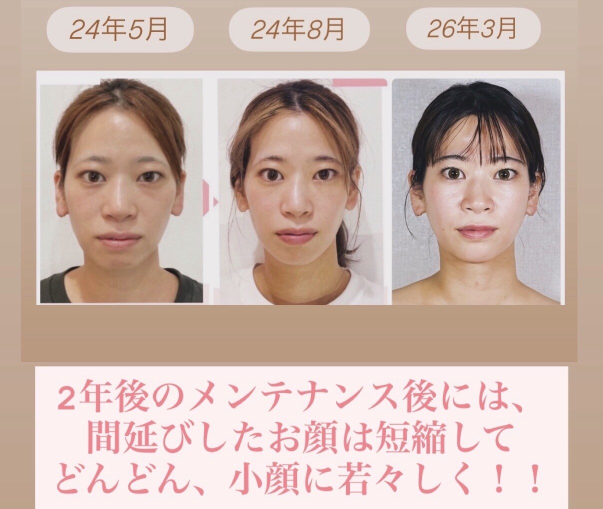 姿勢ケアの施術イメージ