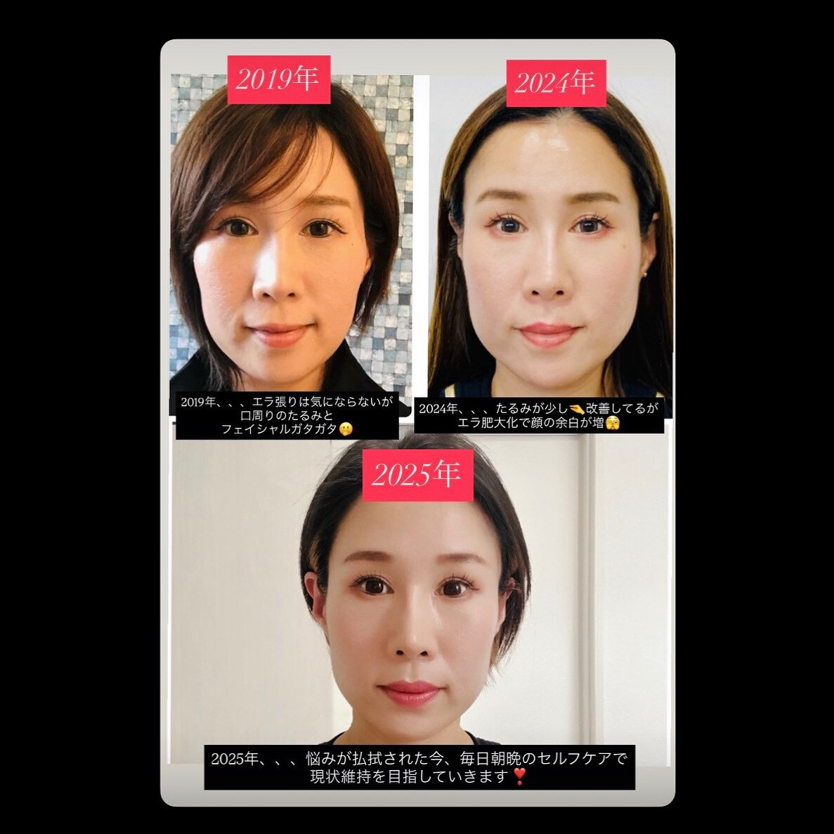 浮腫みスッキリ Before/After